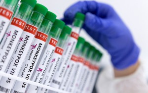 CDC phân phối vaccine phòng bệnh đậu mùa khỉ cho những người có nguy cơ