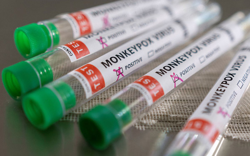 Ống đựng mẫu bệnh phẩm có đánh dấu dương tính với virus gây đậu mùa khỉ. (Ảnh: Reuters)